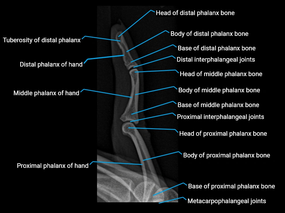X Ray finger  LAT anatomy labelled.webp